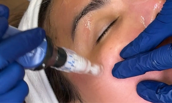 Microneedling in Highland Park: Collagen Renewal for Every Skin Type